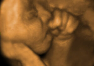 3dface-10-400×284